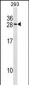 MARCKSL1 Antibody (C-term)